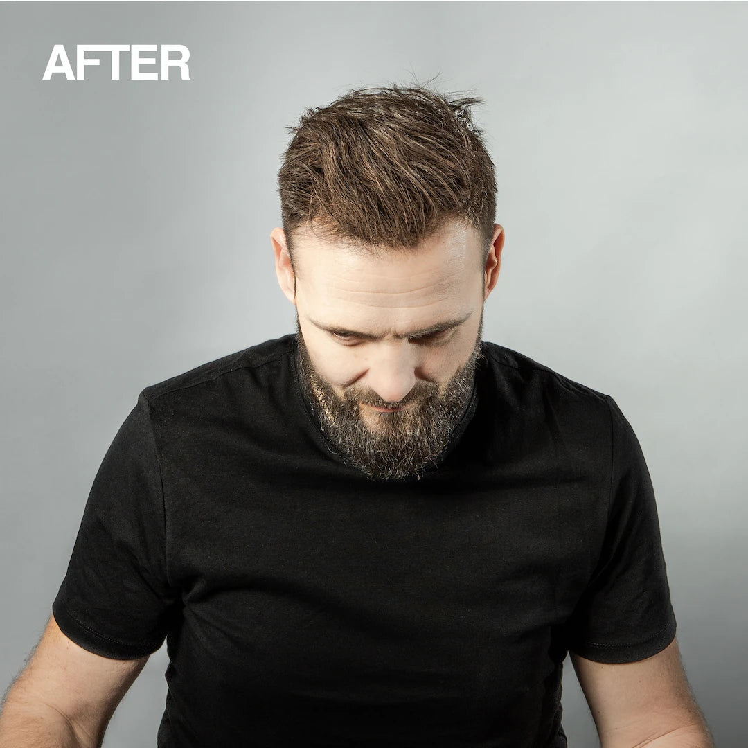 Mane Hair Thickening Spray Weekend Pack | 3-Step Regime