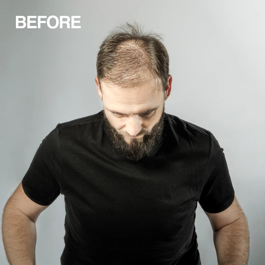 Mane Hair Thickening Spray Weekend Pack | 3-Step Regime